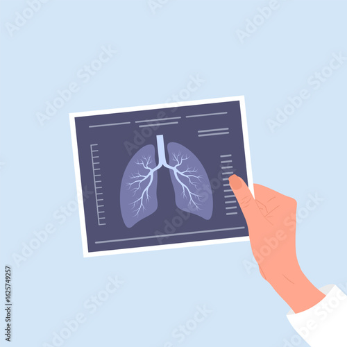 Fluorography concept. Doctor hand holding X Ray scanning. Health lungs check up. Vector illustration in flat cartoon style.