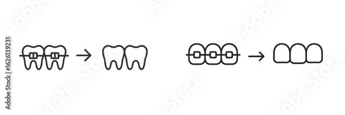 Transformation process from crooked teeth with braces to a straight smile