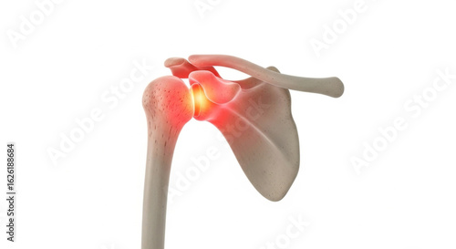 Shoulder joint inflammation depicted with red glow on bones in a medical illustration on white