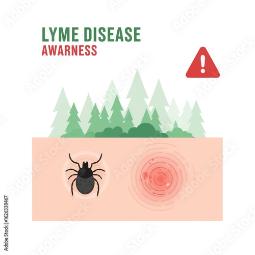 Lyme Disease Awareness: Tick Bite and Bullseye Rash, Prevent Lyme Disease with Awareness and Protection in High-Risk Areas