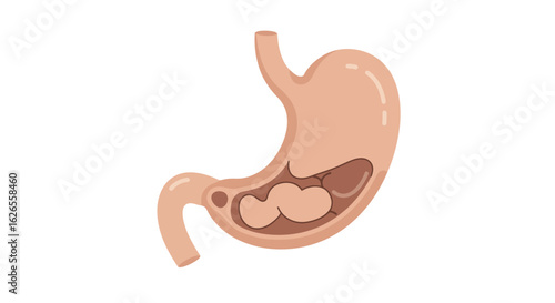 Anatomical Illustration of a Human Stomach with Internal Contents Shown