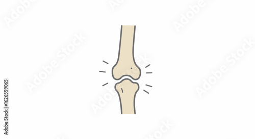Painful Knee Joint Illustration for Medical Education