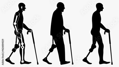 Three silhouettes of men with varying degrees of prosthetic leg technology using walking canes for support