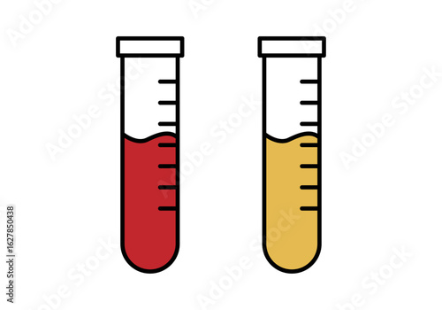 Probetas con muestras de sangre y orina