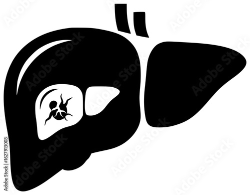 liver human in medical laboratory with blood vessels and bile duct in abdominal cavity