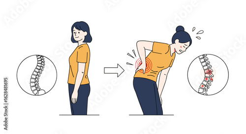 Understanding spinal health and managing lower back pain for improved well-being