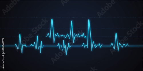 Cardiogram of a heartbeat on a monitor displaying a medical ECG