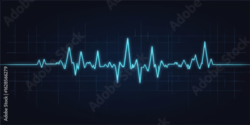 Medical cardiogram showing an electrocardiogram (EKG) of a heartbeat on a hospital monitor with a green line