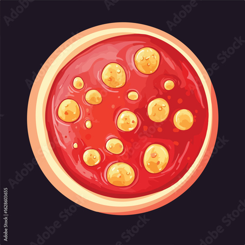 Cholesterol Plaque in Clogged Arteries