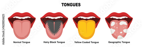 Tongue Anatomy: Detailed illustration showcasing the variety of human tongue conditions and morphology for educational purposes. on transparent background