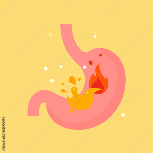 Cartoon illustration depicts a stomach with burning sensation representing heartburn, acid reflux, or indigestion on a yellow background.