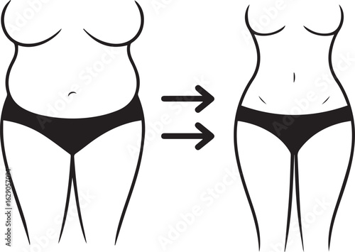 Weight Loss Before and After Illustration