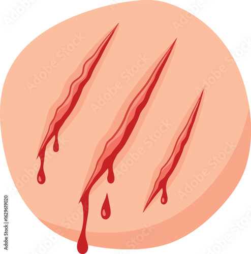 Stylized illustration of three deep bleeding scratches on skin with dripping red blood.