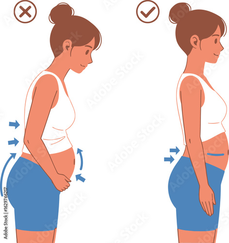 Pregnancy posture guide correct and incorrect standing positions
