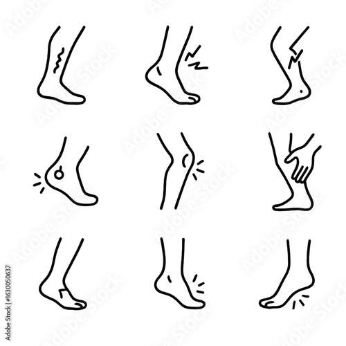 Running Injuries Icons. Outline icon set of running injuries: shin splints, sprained ankle, muscle cramp, blister, runner’s knee,