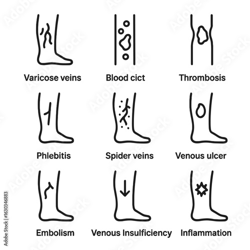 Vein Health Icons. Outline icon set of vein health and conditions: varicose veins, blood clot, thrombosis, phlebitis, spider veins