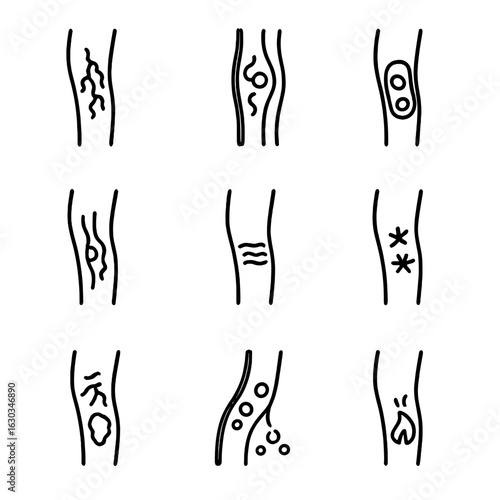 Vein Health Icons. Outline icon set of vein health and conditions: varicose veins, blood clot, thrombosis, phlebitis, spider veins