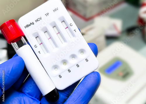 Blood Transfusion viral Rapid Screening Test. Hepatitis (B,C), HIV, Syphilis.