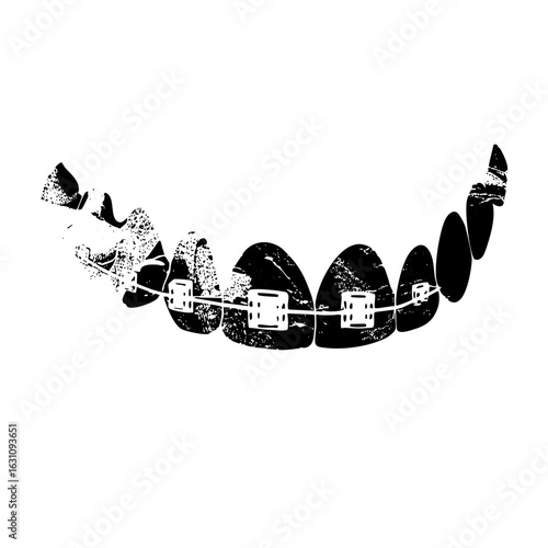 Vector Dental braces with stylized teeth and brackets.