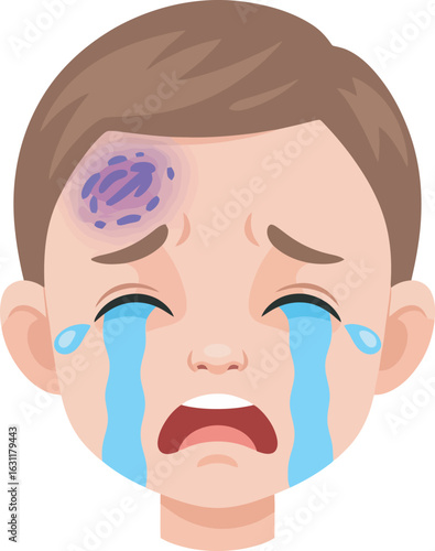 Upset young boy with a painful forehead bruise crying with tears streaming down his face.