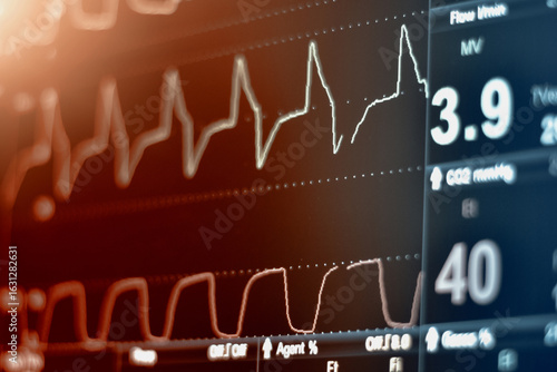 EKG monitor in intra aortic balloon pump machine in icu on blur background, Brain waves in electroencephalogram, heart rate wave
