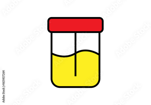 Frasco de análisis con muestra de orina 