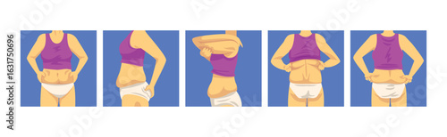 Female Torso with Sagging Belly and Soft Muscles Vector Set