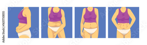 Female Torso with Sagging Belly and Soft Muscles Vector Set