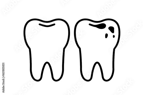 Clean vs. Decayed Tooth: Simple Line Art Illustration for Dental Hygiene, Oral Health, and Healthcare Websites.