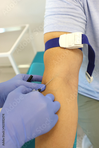 Healthcare professional performing venipuncture with syringe on patient’s arm, tourniquet applied, blue gloves ensuring sterile blood collection procedure.