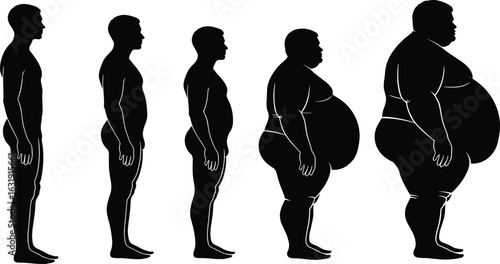 Human Body Weight Progression, Obesity Stages, Health and Fitness, Weight Gain, Body Transformation, Medical Illustration, Side View Silhouettes, Comparison