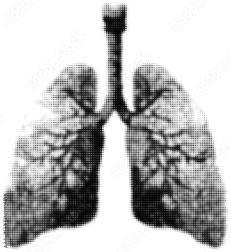 Monochrome halftone illustration of human lungs with bronchial details