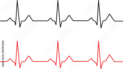 heart beat cardiogram