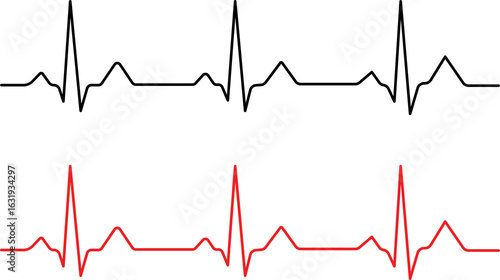 heart beat cardiogram