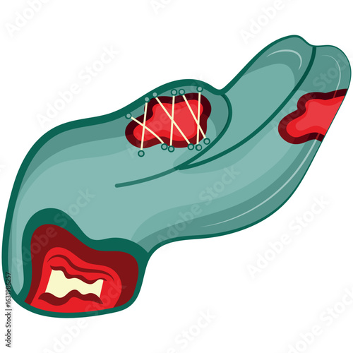 cartoon zombie hand in blue with open wounds and bones that folds into a gesture with an outstretched hand, Halloween design