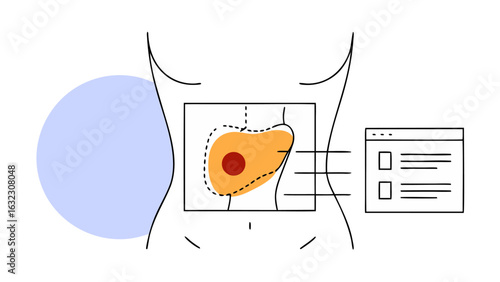 Liver Disease Illustration, Medical Vector Graphic for Healthcare Website