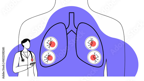 Vector Illustration of Doctor Examining Lungs with Virus Infection