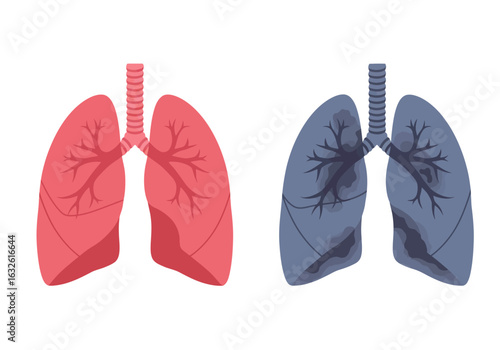 Illustration of healthy red lungs alongside unhealthy diseased blue lungs