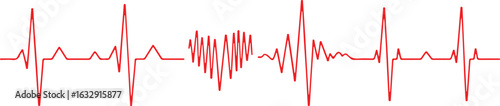 A red electrocardiogram (ECG) waveform showing a normal heartbeat pattern interrupted by an irregular, rapid pulse.