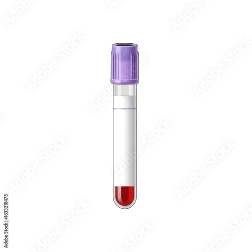 A close-up image of a blood collection tube with a purple cap, containing blood.