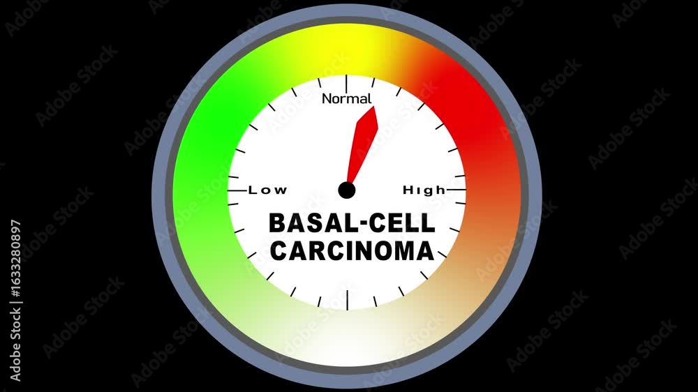 Basal-cell carcinoma text or word displayed with a barometer or ...