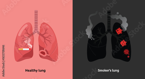 Smoking Health Impact Healthy and Smoker Lungs