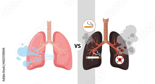 Healthy vs Damaged Lungs Respiratory System Health Comparison
