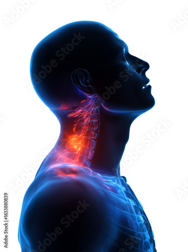 3D-rendered illustration of the spine and neck, with vibrant blue and red highlights on pain areas. Front view of a man's head