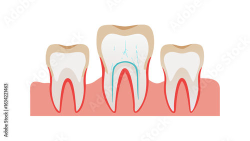 Detailed diagram illustrating the anatomy of human teeth, showcasing roots and surrounding gums in a dental context for educational purposes