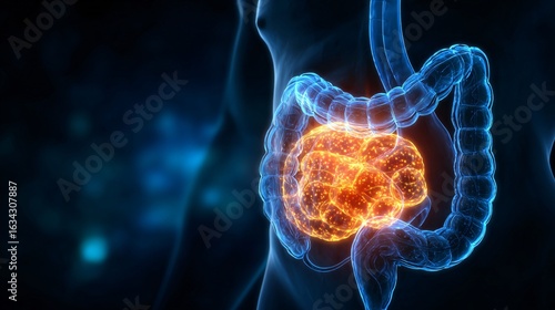 Illustration of Human Stomach Cancer and Gastric Tumor for Medical Professionals