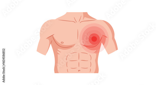 Vector Medical Illustration of Human Chest with Highlighted Breast Pain in Modern Minimalist Style