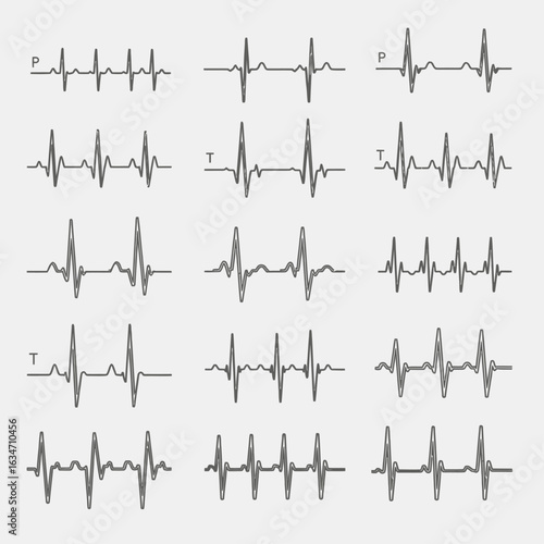 Set of ECG Waveforms – PQRST Variations for Cardiology and Medical Use