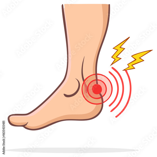 Illustration of a Human Foot and Ankle Experiencing Pain with Red Rings and Lightning Bolts