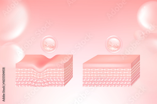 Hyaluronic acid and Niacinamide before and after skin solutions ad, pink collagen serum drops into skin cell with cosmetic advertising background ready to use, illustration vector.